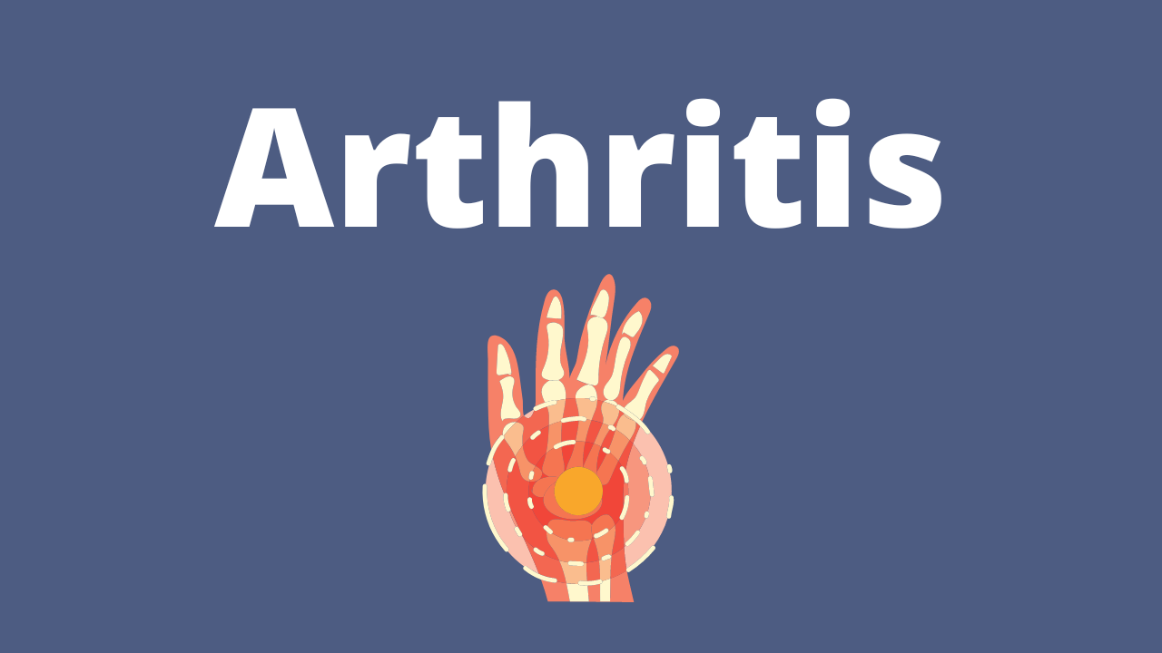 Arthritis – CBD Specialist HempSapa®