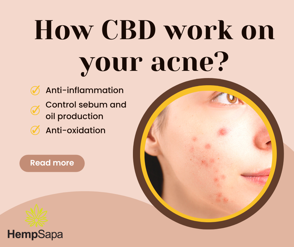 How CBD work on acne