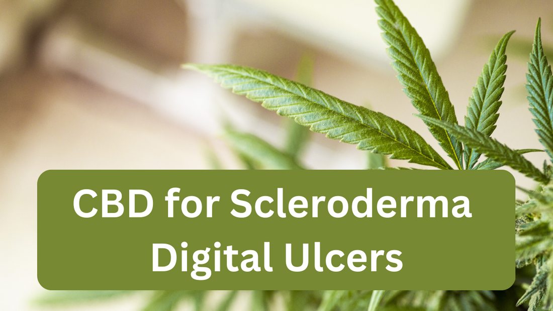 Study on CBD as a Treatment for Scleroderma Digital Ulcers